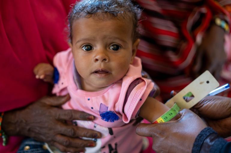 UNICEF Sudan_nutrition_2543